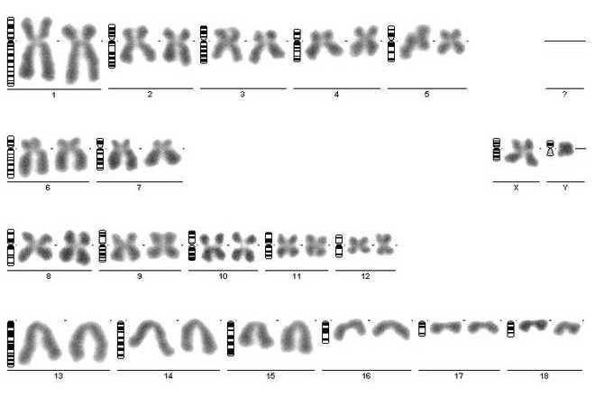 Karyogram of a pig cell. No banding. image