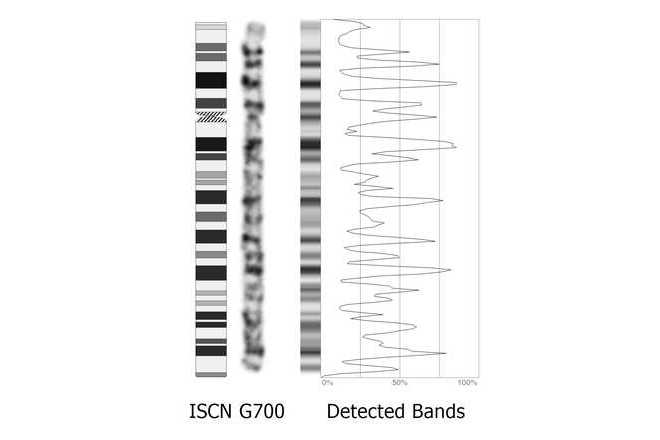 Klasifikace chromozomů image