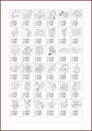 Karyotyping Summary Report image