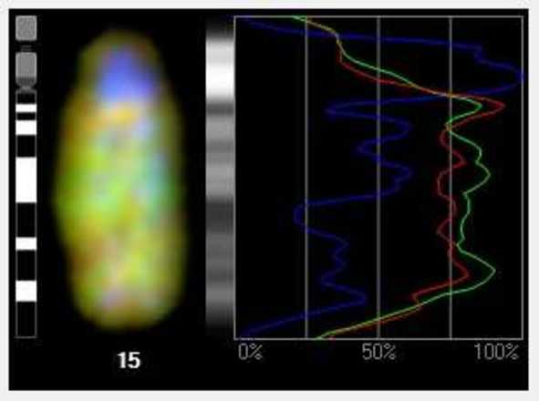 Use profile graphs to study intensity profile of each individual color channel. image