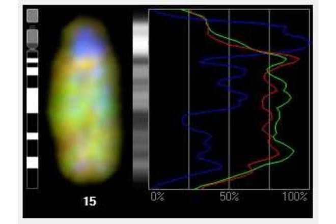 Use profile graphs to study intensity profile of each individual color channel. image