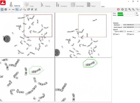 Chromosome collecting image