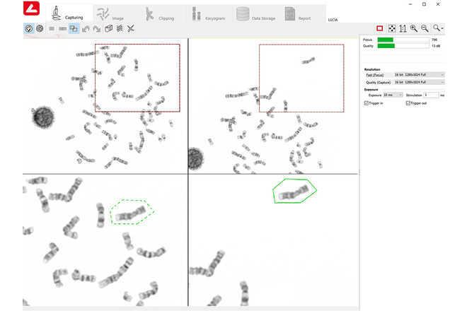 Chromosome collecting image