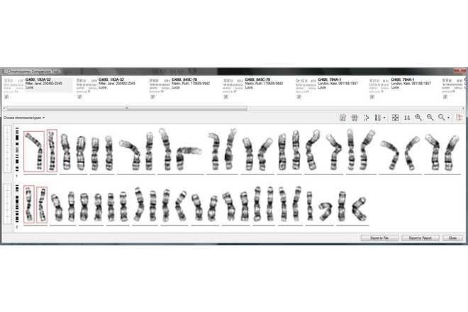 Comparison of chromosomes from different examinations image