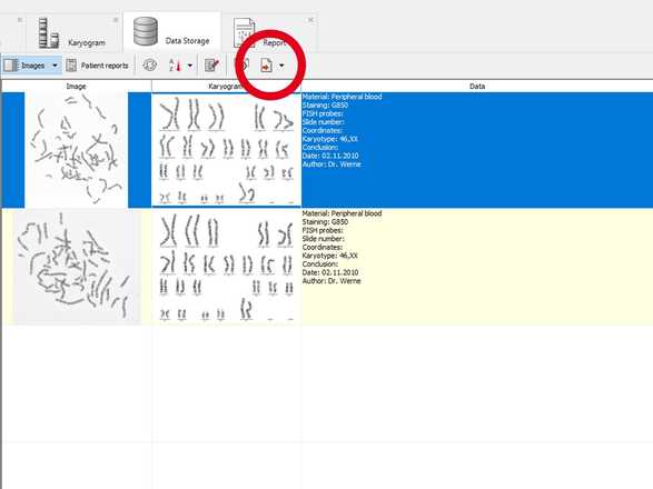 Step 2: One Click to Create Report from the Current record image
