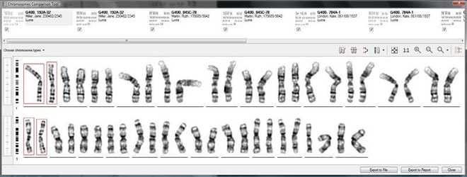 Nástroj pro porovnávání chromozomů image