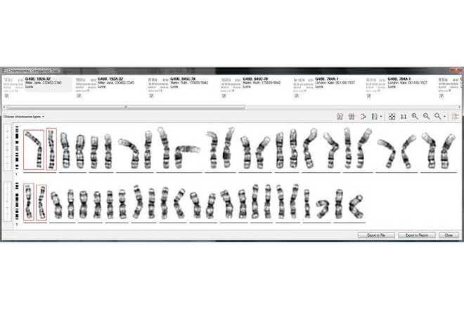 The Chromosome Comparison Tool image