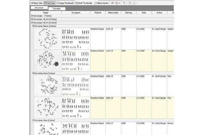 Tabular (Grid) View image