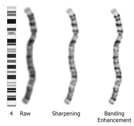 Example of enhancements to the appearance of chromosome no. 4, from left: raw image, sharpened image, enhanced banding image