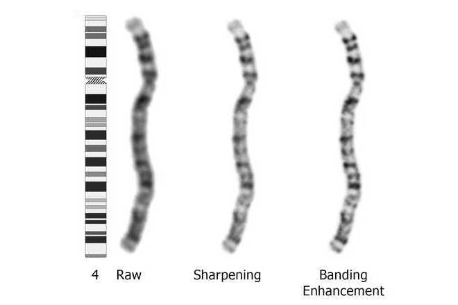 Ukázka vylepšení vzhledu chromozomu č. 4, zleva: nezpracovaný obraz, zostřený obraz, zvýrazněné pruhování image