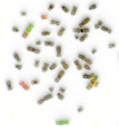 The counterstaining component displayed as inverted image