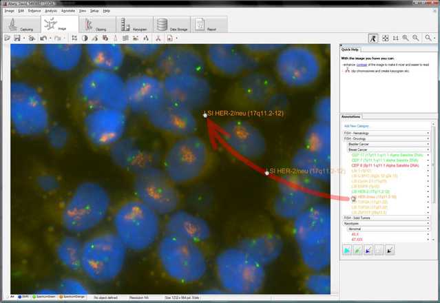 Drag-and-drop annotation tool image
