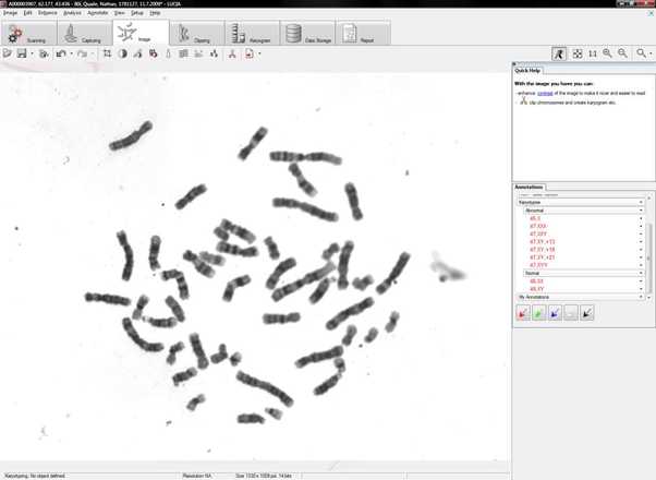 High magnification image ready for analysis image