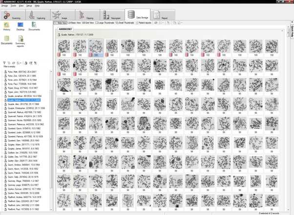 Gallery of metaphase thumbnails after the search image