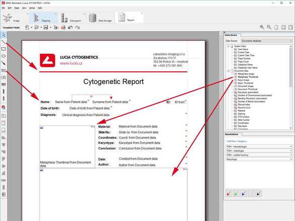 Report Editor Tools image
