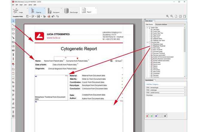 Report Editor Tools image