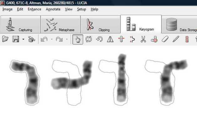 Chromosome adjustments image