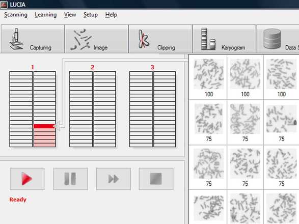 The scanning progress is indicated during scanning image