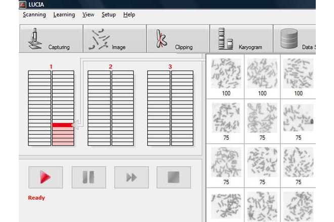 The scanning progress is indicated during scanning image